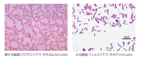 痩せる細菌太る細菌