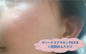 ヴィーナスプラセンタEX
