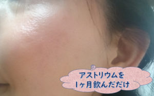 アストリウム