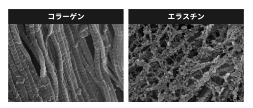 エラスチン