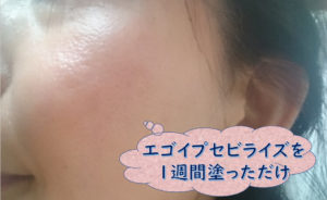 エゴイプセビライズ