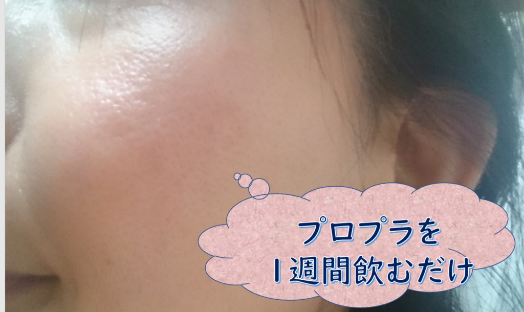 プラプロ