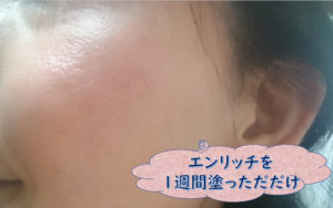 ファンケルエンリッチ