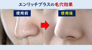 エンリッチプラス