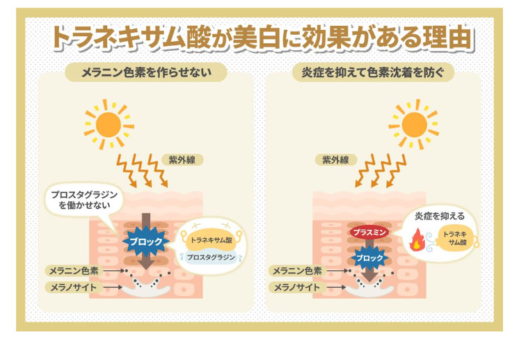 トラネキサム酸