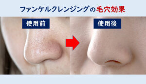 ファンケルクレンジング