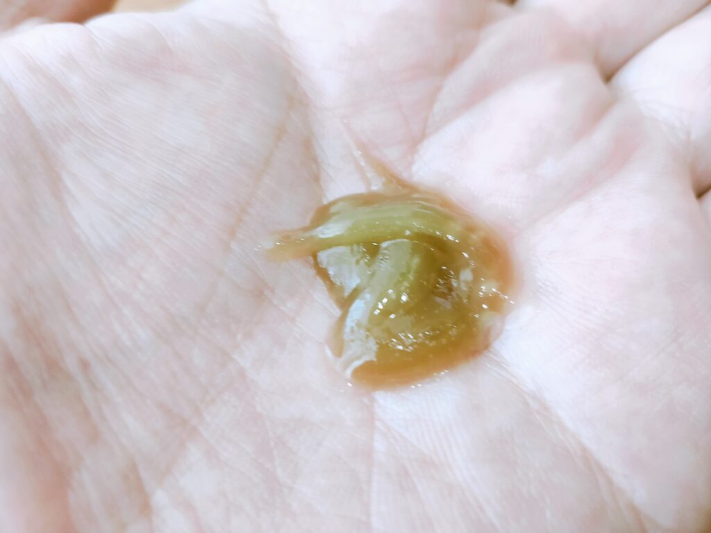 ネオちゅらびはだ