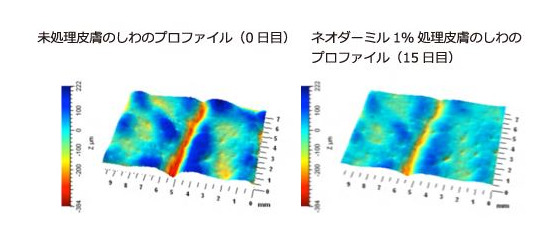 ネオダーミル