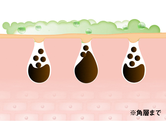 ネオちゅらびはだ