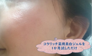 コラリッチオールインワン薬用美白ジェルクリーム