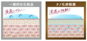 ラントゥルース